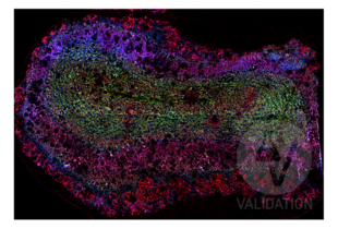 Multiplex Immunohistochemistry validation image for anti-Discs, Large Homolog 4 (Drosophila) (DLG4) antibody (ABIN361694)