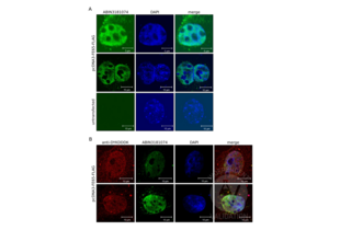 Immunocytochemistry validation image for anti-DYKDDDDK Tag antibody (ABIN3181074)