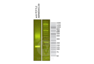 Cleavage Under Targets and Release Using Nuclease validation image for anti-Transcription Factor 7-Like 2 (T-Cell Specific, HMG-Box) (TCF7L2) antibody (ABIN6945139)